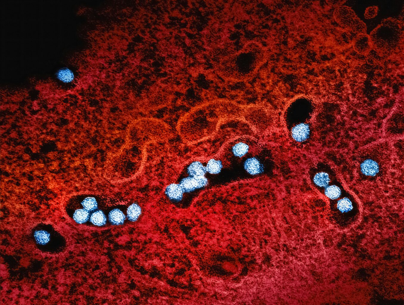 virus Zapadnog nila
